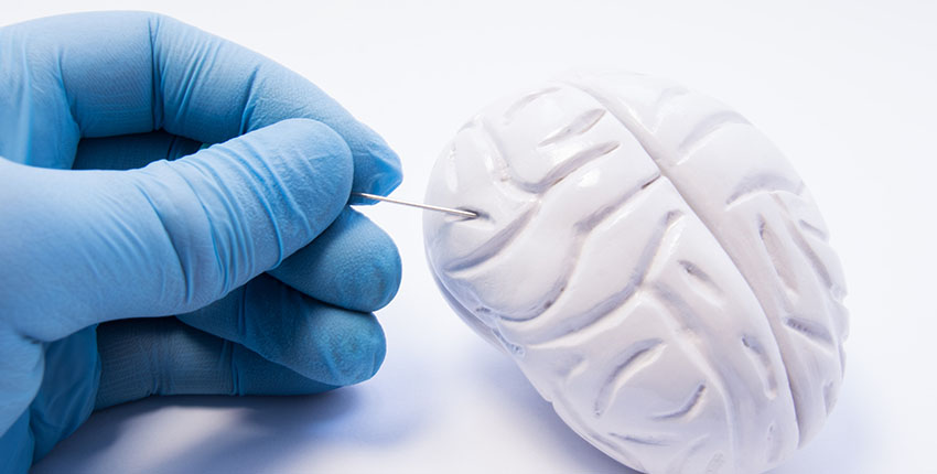 A gloved hand examines a small model of a brain