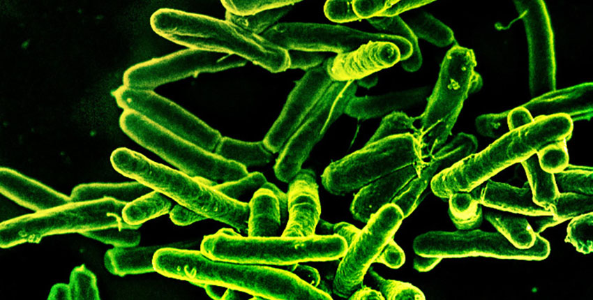 Rod-shaped Mycobacterium tuberculosis, the bacterium that causes TB, glowing green against a dark background in a scanning electron micrograph