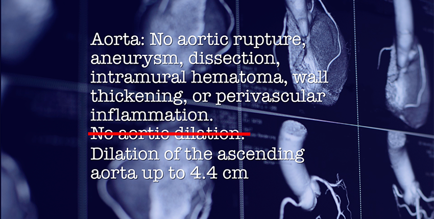 Text over angled view of CT scans of the heart