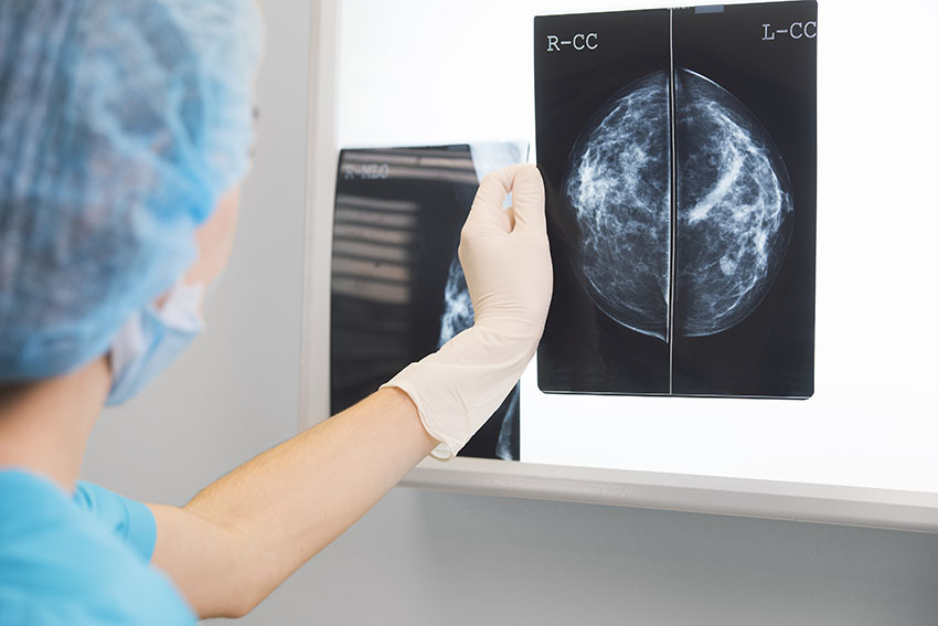 A clinician (a doctor or a nurse) looks at an X-ray scan of breast cancer