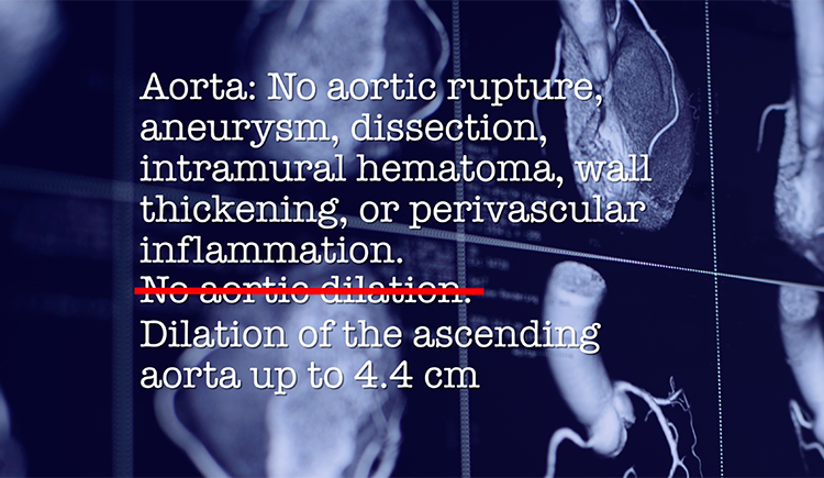 Text over angled view of CT scans of the heart